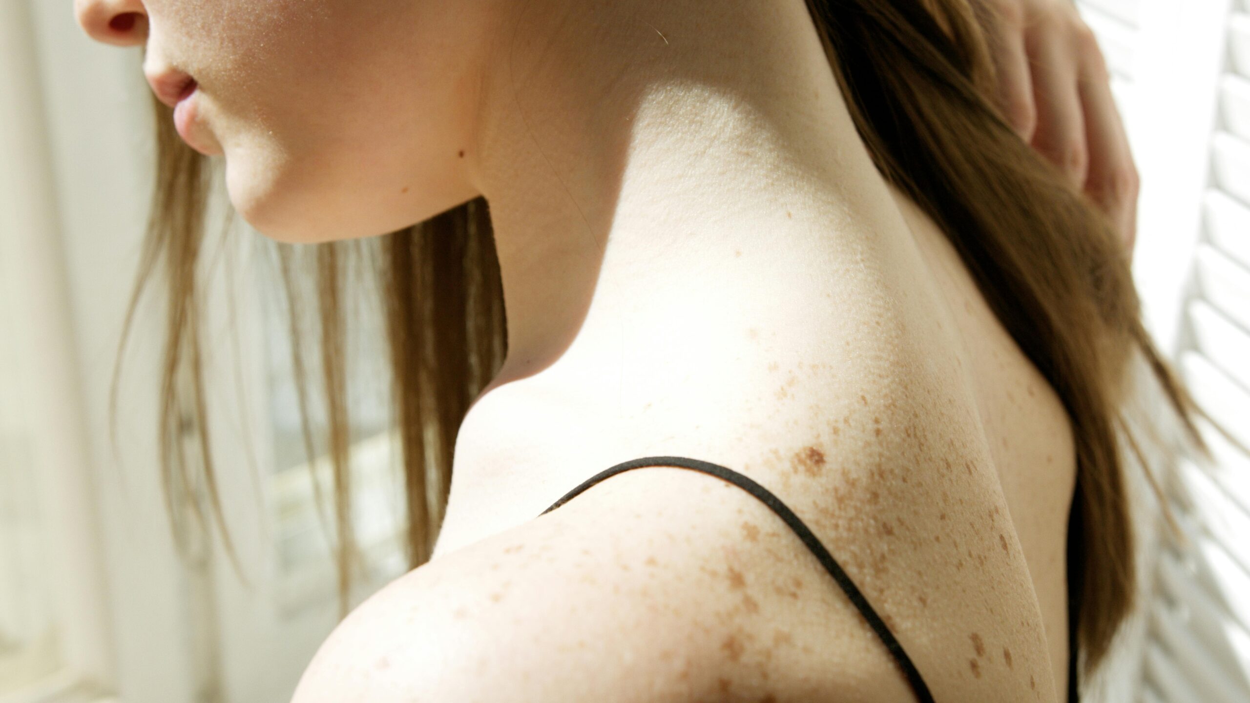 Hautkrebsscreening Dermatoskopie