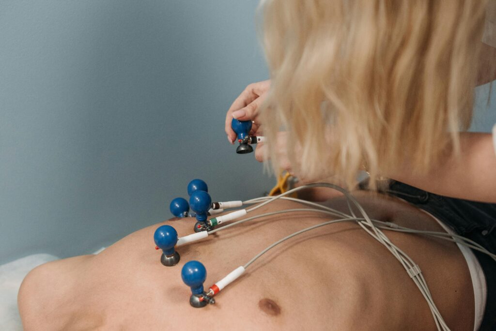 EKG